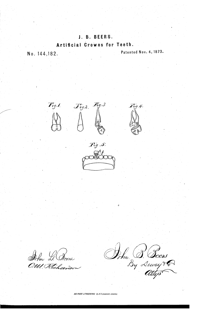 John Beers, dentist, patented an improved gold crown for teeth (1873).